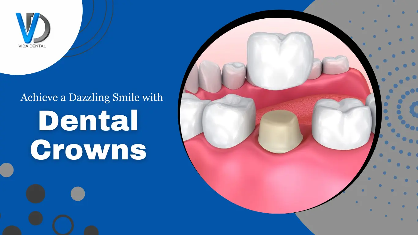 Porcelain-Crowns-Vida-Dental