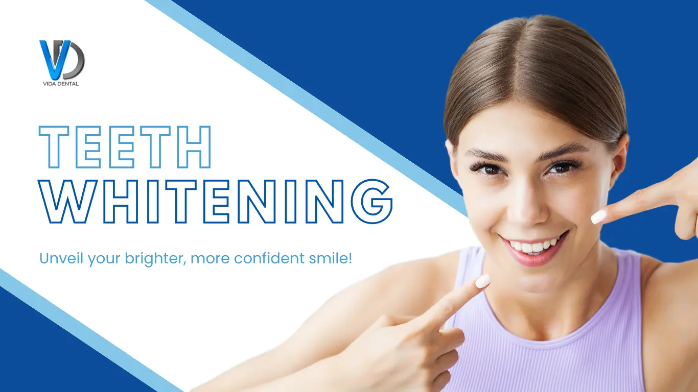 Vida dental Teeth Whitening