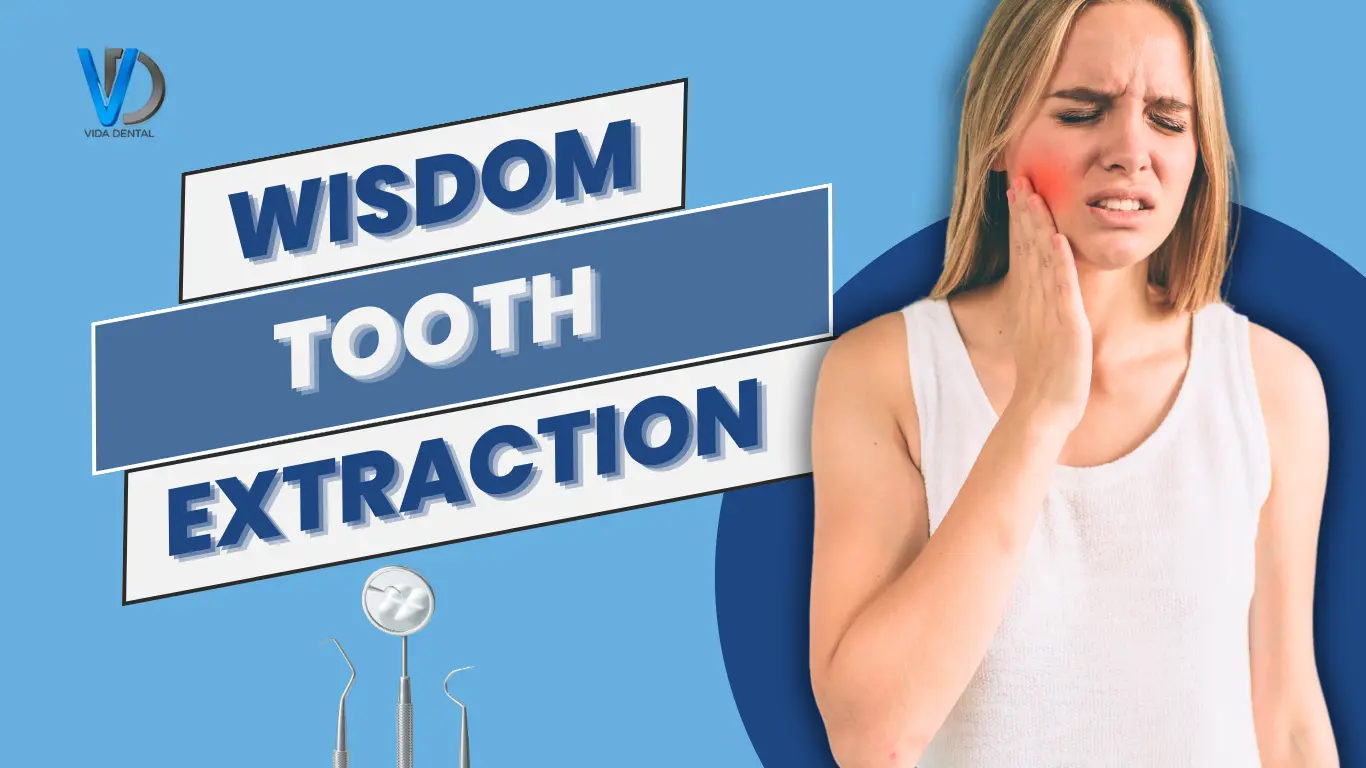 Vida dental-Wisdom tooth extraction