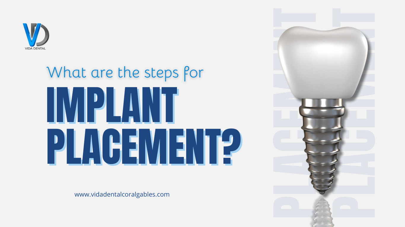 Vida dental-Implant placement