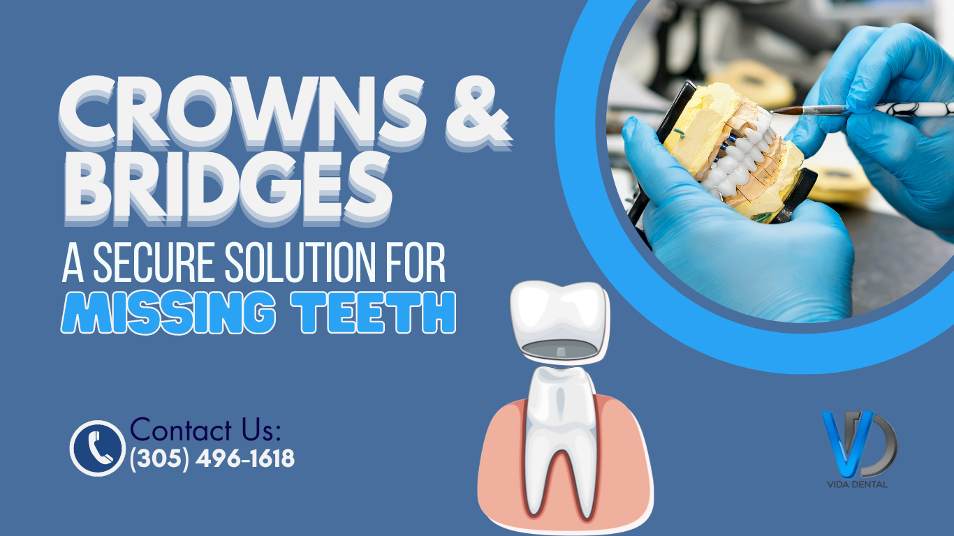 Vida dental-Crowns & bridges