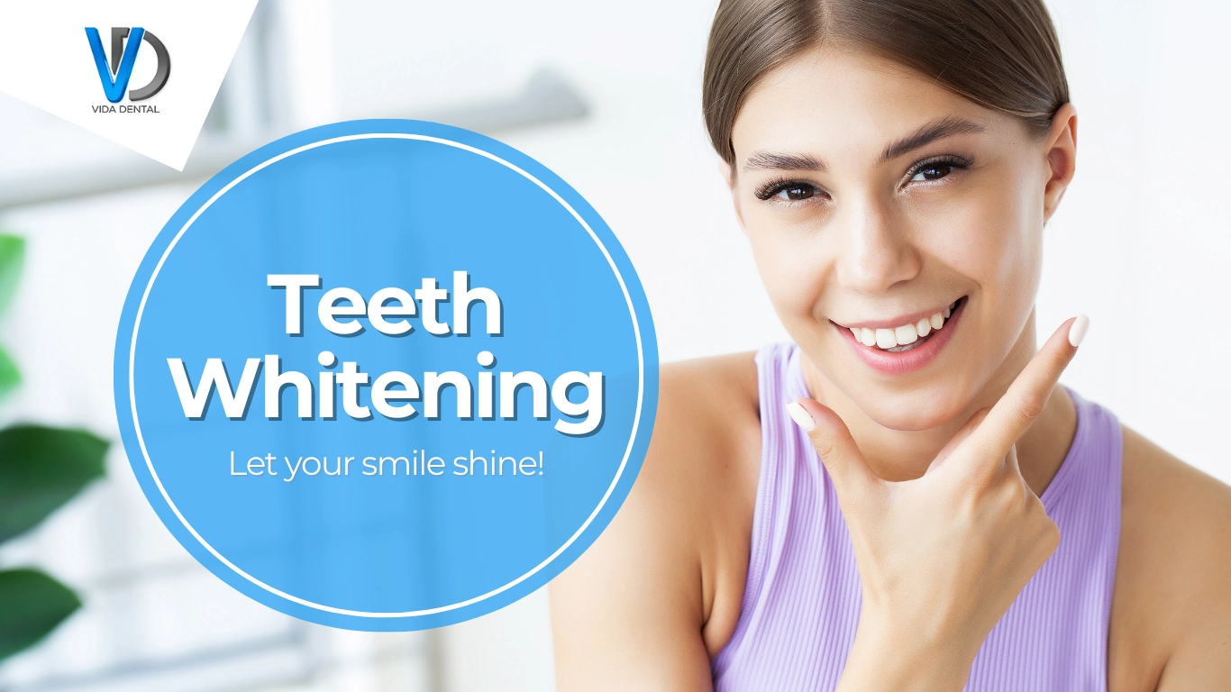 Vida Dental Teeth Whitening