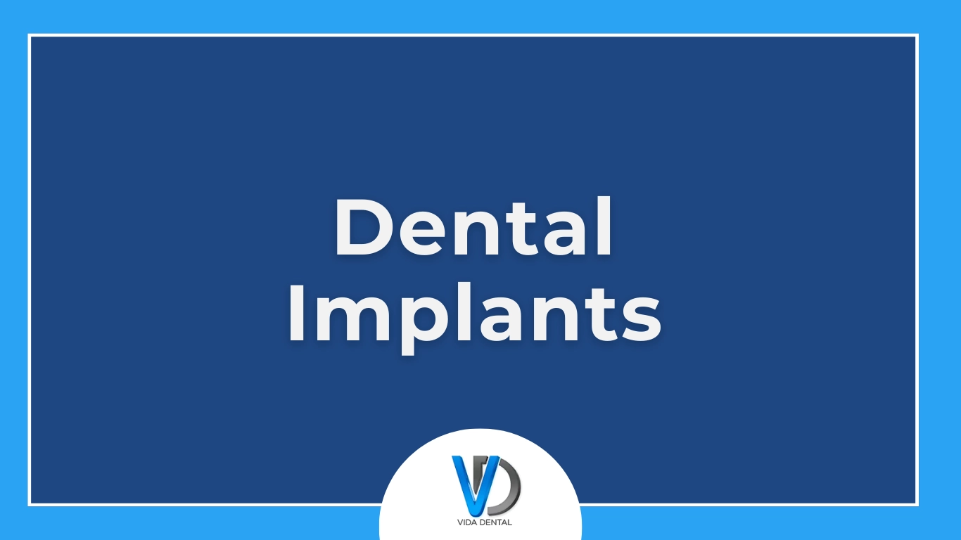 Vida-Dental implants