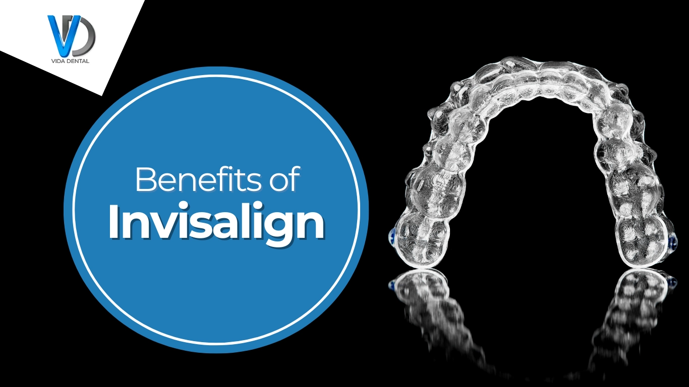 Vida Dental Invisalign