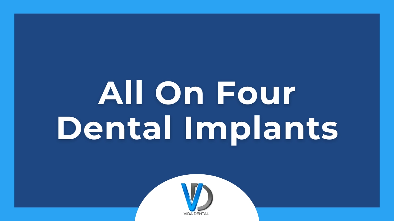 All On Four Dental Implants