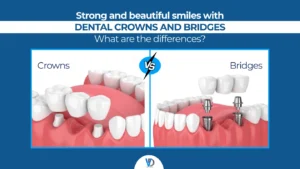 Dental Crowns and Bridges