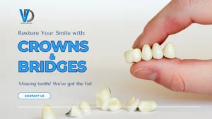Vida Dental - Crowns & Bridges