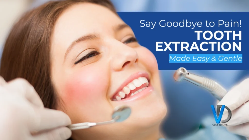 Tooth Extraction and Its Types: What You Should Know