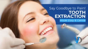 Tooth Extraction and Its Types: What You Should Know