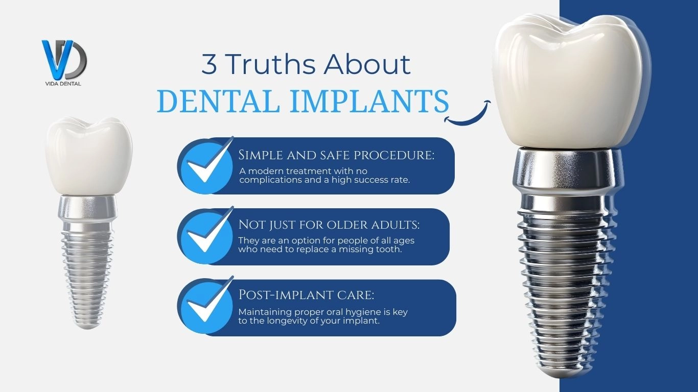 Dental Implants at Vida Dental | The Modern Smile Upgrade for Lasting Confidence